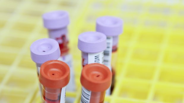 Αιμοδοσία: Συνεχίζεται ακόμα το στίγμα προς τα άτομα που εργάζονται στο σεξ;