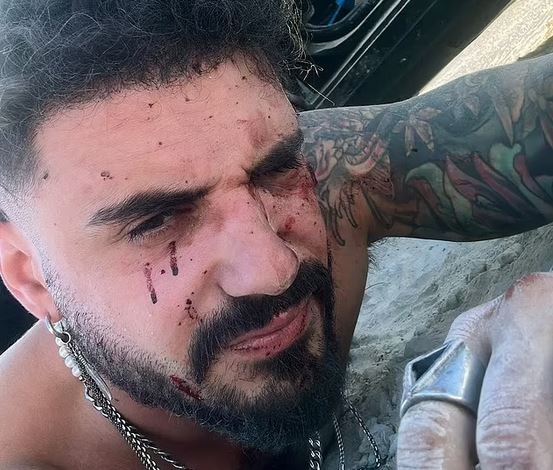Ισραήλ: 28χρονος περιγράφει πώς επέζησε από το μουσικό φεστιβάλ - «Δέχτηκα δύο σφαίρες στην πλάτη» | tanea.gr