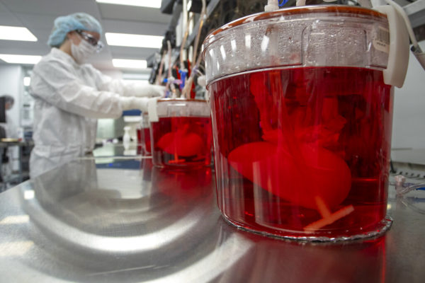 ΗΠΑ: Πέθανε ο πρώτος ασθενής που έλαβε γενετικά τροποποιημένο νεφρό από χοίρο
