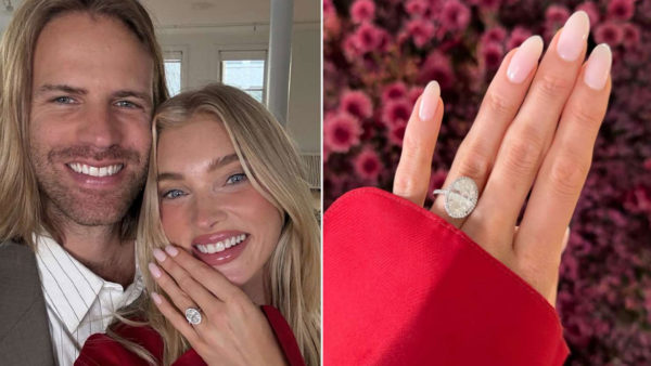 Elsa Hosk – Tom Daly: Αρραβωνιάστηκαν μετά από 10 χρόνια σχέσης – Το εντυπωσιακό δαχτυλίδι που της χάρισε