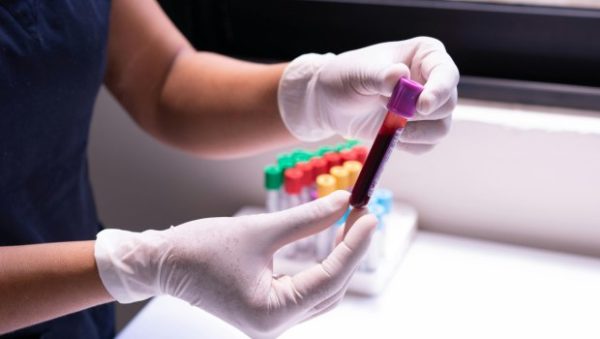 «Ολιστική» εξέταση αίματος ανιχνεύει 59 ασθένειες – Από λοιμώξεις μέχρι καρκίνους
