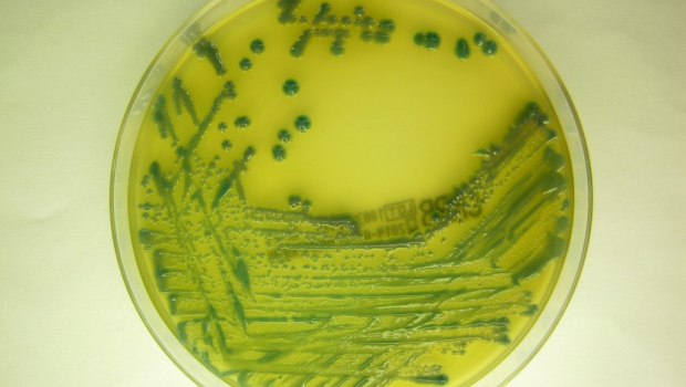 Μείωση 40% των νοσοκομειακών λοιμώξεων απέτρεψε 17.000 μέρες νοσηλείας επιπλοκών