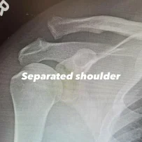 Channing Tatum: Στο νοσοκομείο ο Αμερικανός ηθοποιός – Τι συνέβη