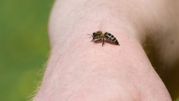 Πότε ένα τσίμπημα μπορεί να οδηγήσει στο θάνατο – Τι είναι το αλλεργικό σοκ και τι πρέπει να προσέξετε