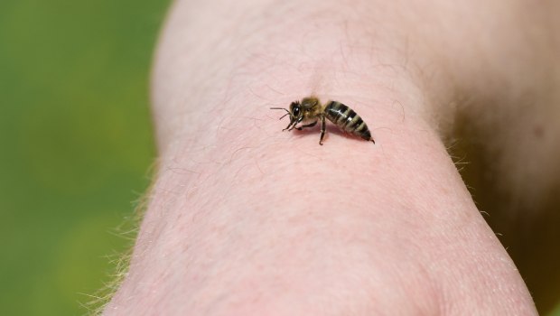 Πότε ένα τσίμπημα μπορεί να οδηγήσει στο θάνατο – Τι είναι το αλλεργικό σοκ και τι πρέπει να προσέξετε