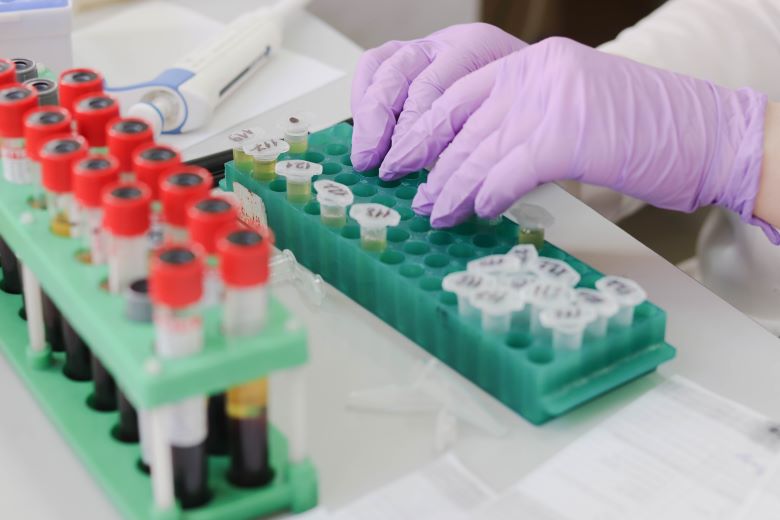 Θανατηφόρα παραλλαγή της γρίπης των πτηνών εντοπίστηκε στην Αυστραλία